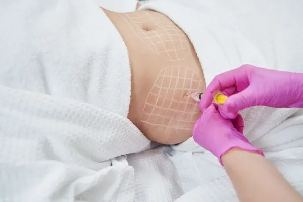 image of fat dissolving injections on love handles to help combat weight gain Littlehampton