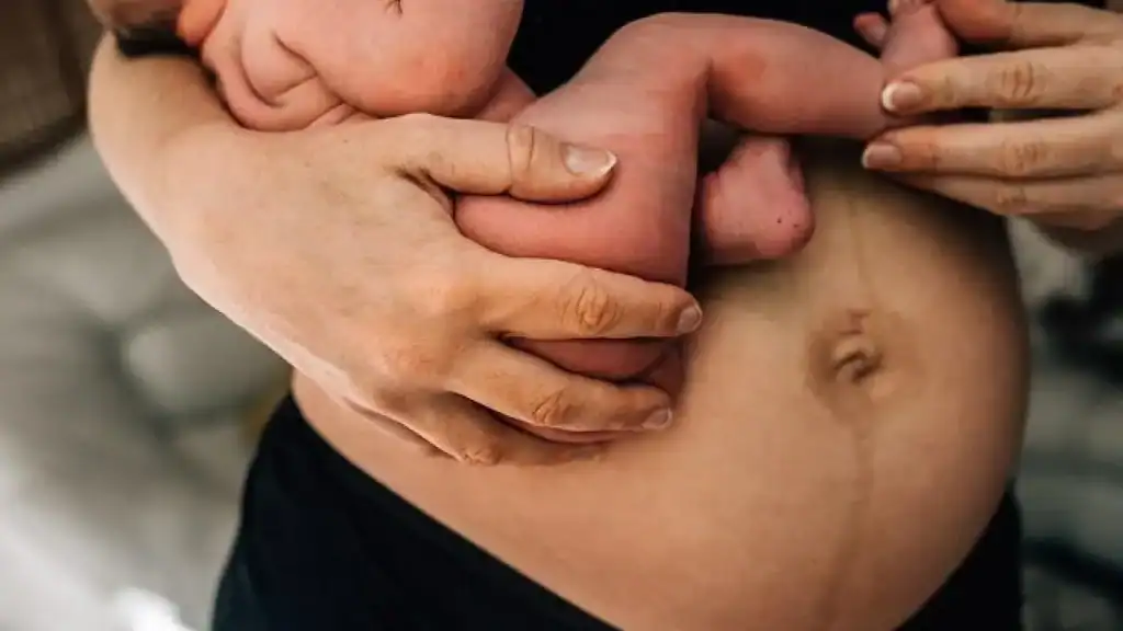 Why Is My Stomach Still Big After Pregnancy Littlehampton?